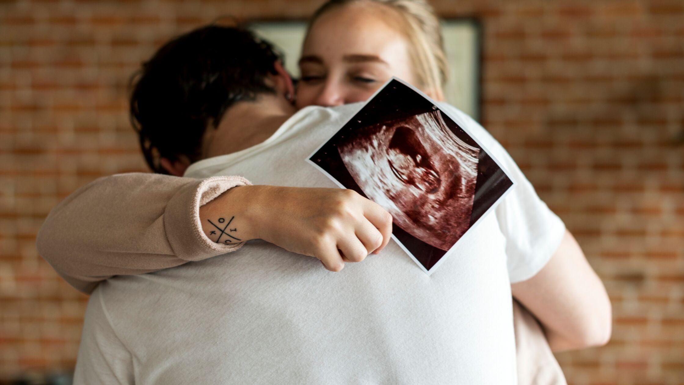 Junges Paar freut sich über das Ultraschallbild seines Kindes